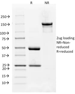 VEGFR1/Flt-1 Antibody (FLT1/658), Novus Biologicals:Antibodies:Primary